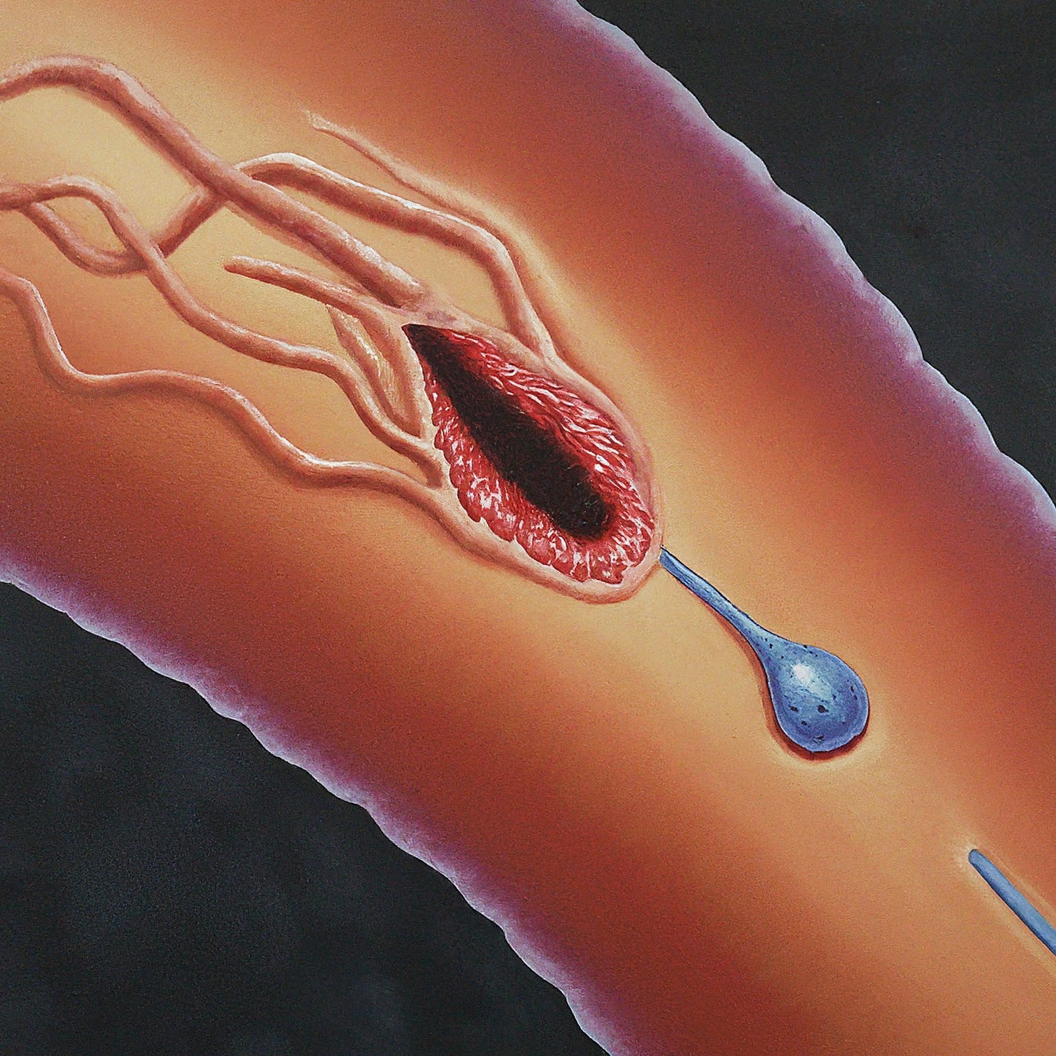 the Importance of Proteins in The Wound Healing Process